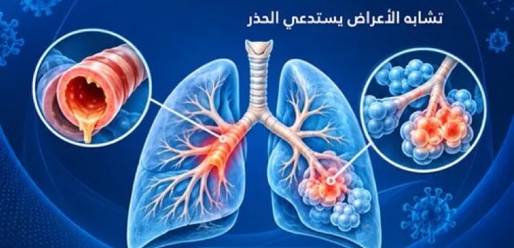سعال وضيق تنفس.. «سعود الطبية» تكشف الفرق بين التهاب الشعب الهوائية والالتهاب الرئوي